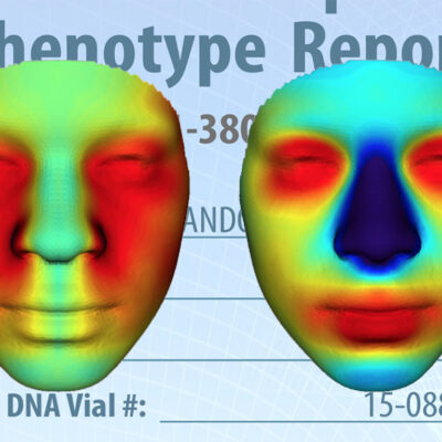 Computerized face reconstruction from Parabon report