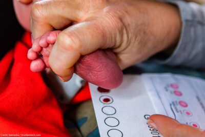 A newborn heel prick being performed.