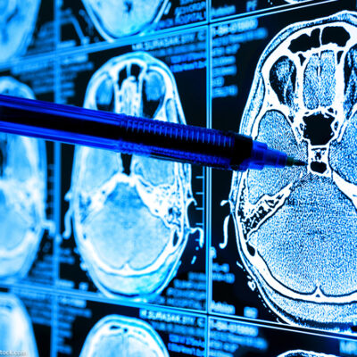 A Doctor points to AI biomedical algorithm screen.