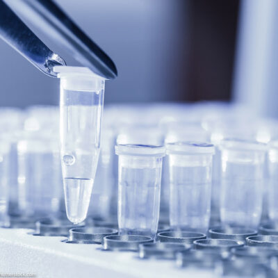 Close-up of tweezers loading test tubes with sampled DNA.