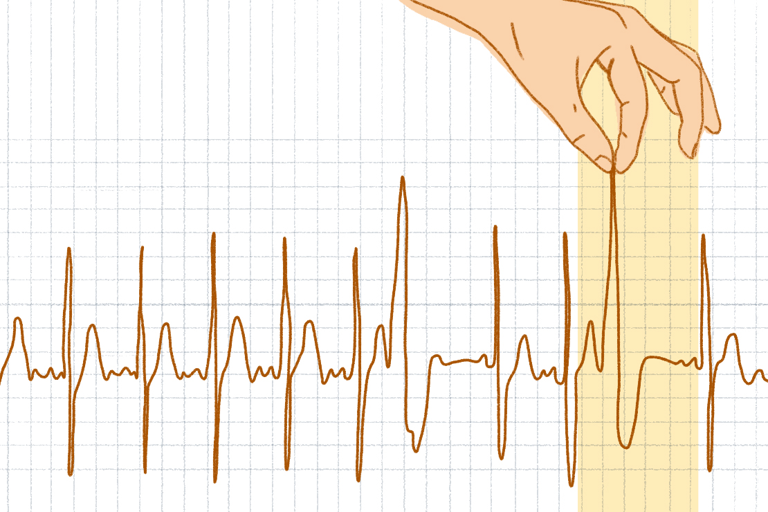 An illustration featuring a hand clasping heart monitor waves.